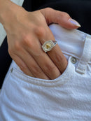 Anel de Fivela Inicial